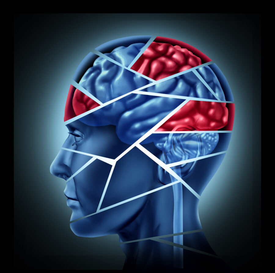 How to Prove TBI in a Personal Injury Case