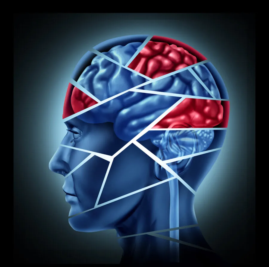 Mental disorder and neurological injury represented by a human head and mind broken in pieces to symbolize a severe medical mental trauma and cognitive illness