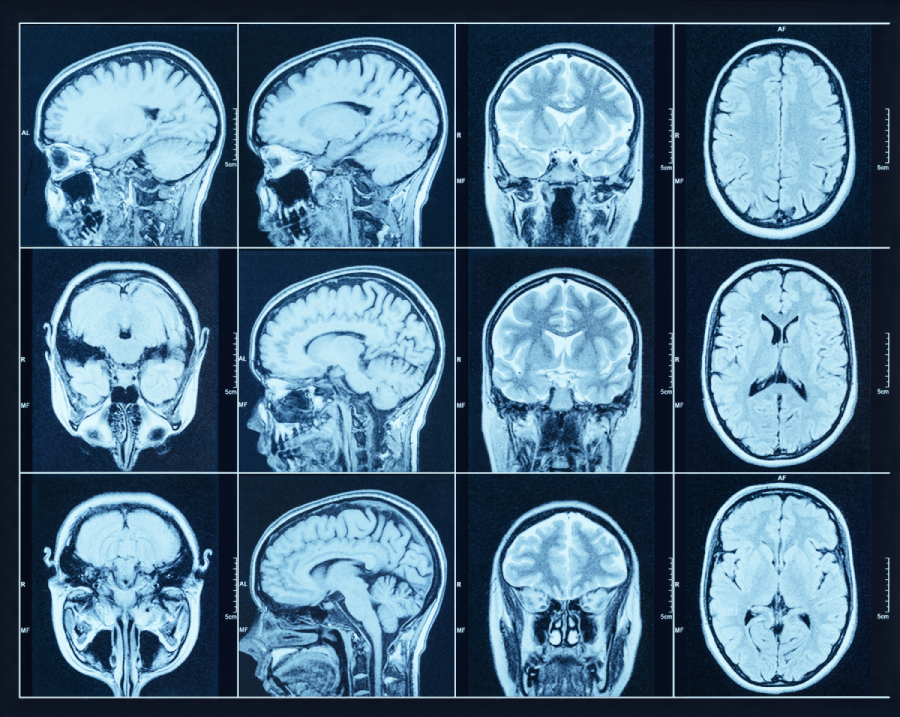 Closeup of a CT scan with brain. Science and education mri background.