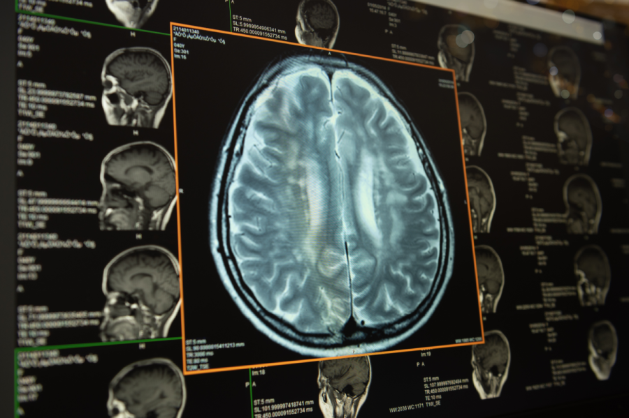 brain image on screen computer from CT scan or MRI scan. healthcare and medicine concept